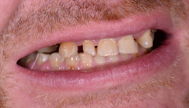 Before