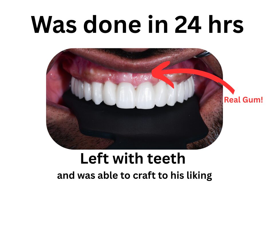 Was done in 24 hrs