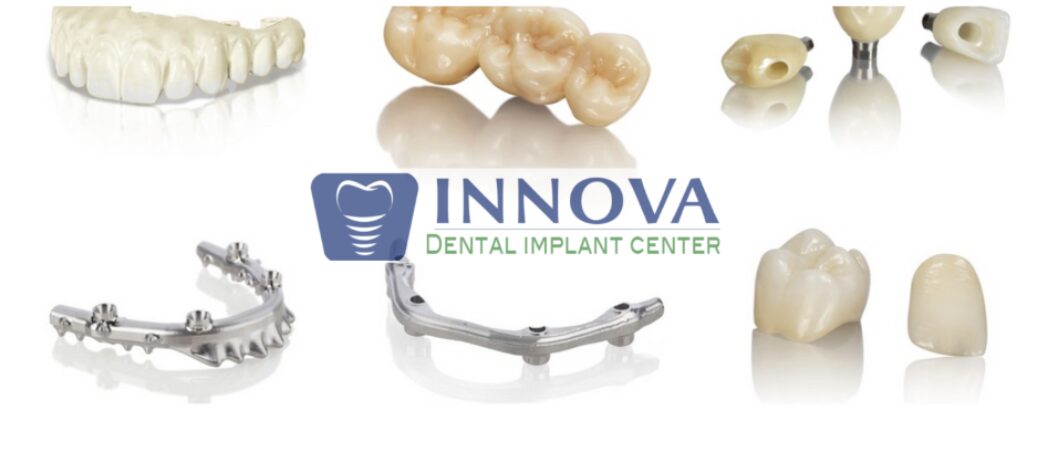 In-house dental laboratory at Innova Prosthodontics specializing in digital implant solutions and custom prostheses
