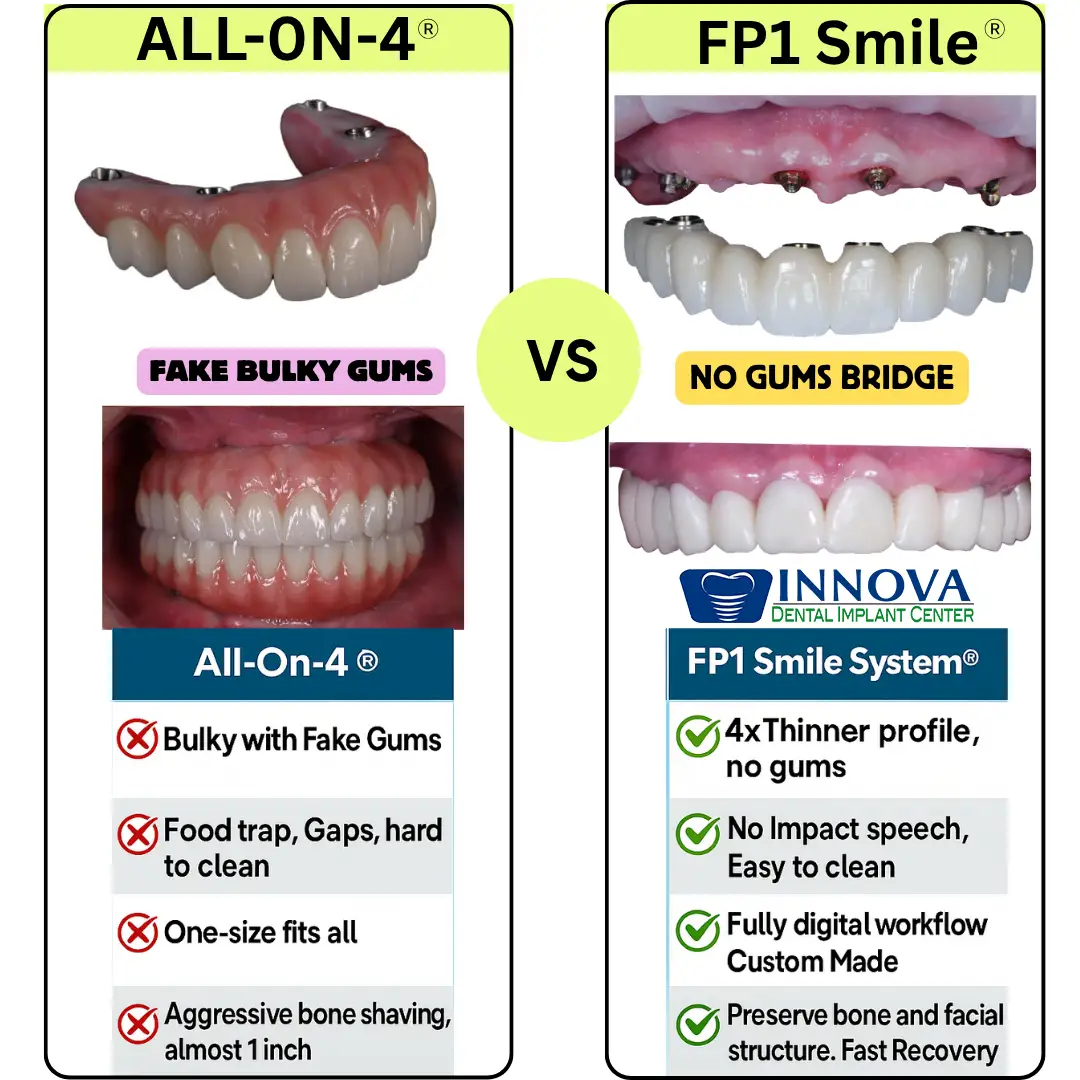 FP1-vs-All-on-4-FP3-The-Truth-Behind-the-Marketing-Hype