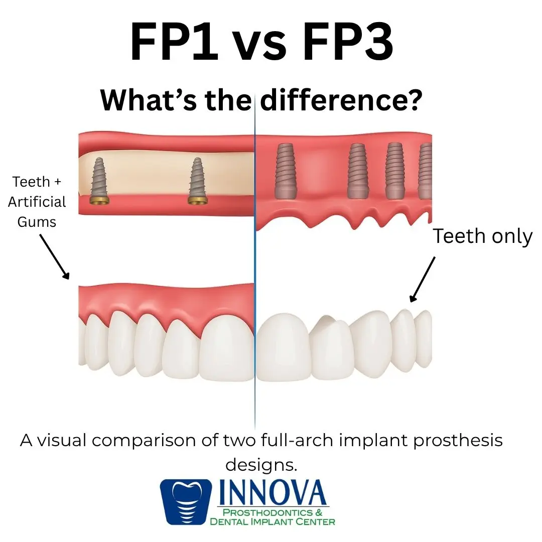 FP1 vs FP3 dental implants